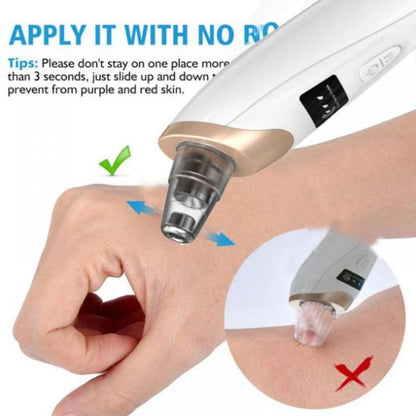 Blackhead Remover Vacuum – Portable Pore Cleaner with LED Display & Adjustable Suction